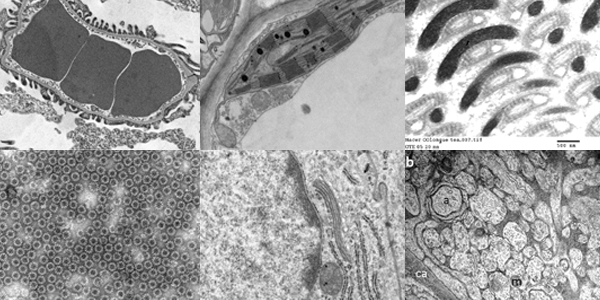 Fokus auf... Alternativen für Uranylacetat
