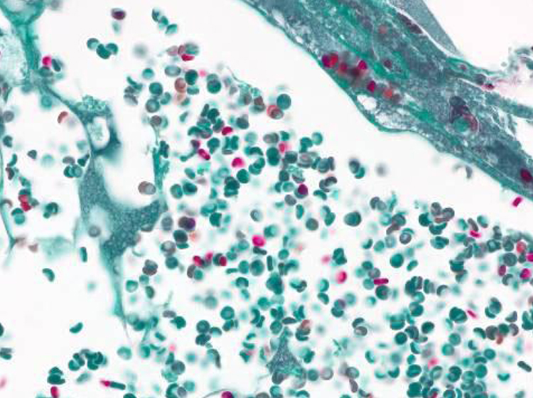 Blutgefäße im Hellfeld Aufgenommen mit ZEISS Axiolab 5