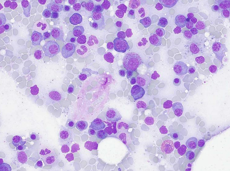 Knochenmark im Hellfeld Aufgenommen mit ZEISS Axioscope 5