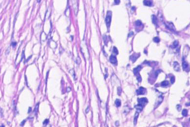 Lunge, aufgenommen im Hellfeld