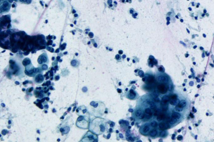 Lunge, aufgenommen im Hellfeld