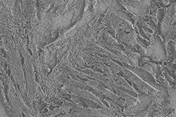 Nanosuit - pathological specimen