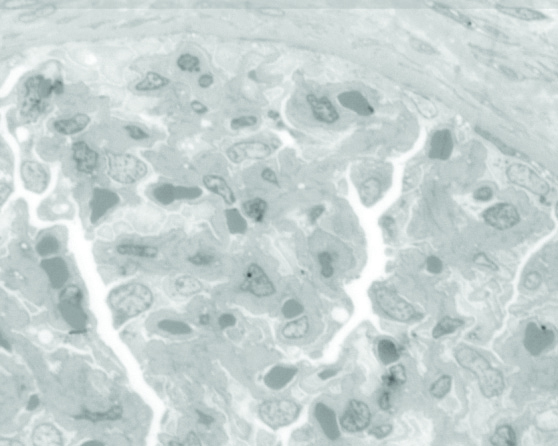 Firm - Comparison of toluidine blue staining