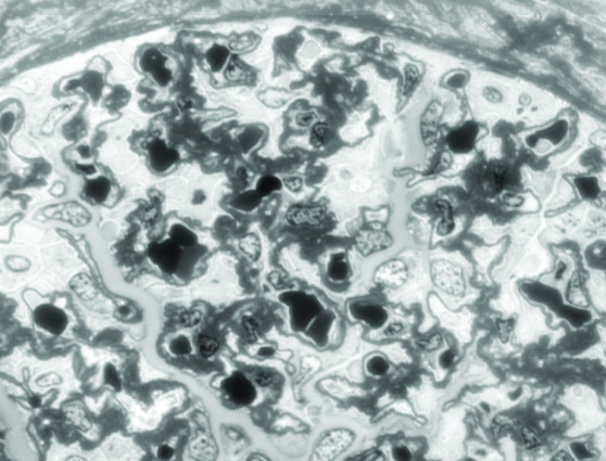 FIRM - on near adjacent sections of human kidney
