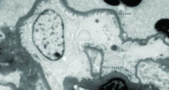 High power FIRM image (bottom) of glomerulus