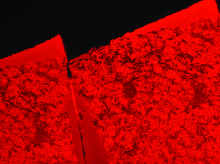 FIRM - Human anterior pituitary, FIRM, rhodamine channel