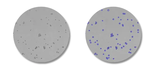 Figure 4. Image of clumped cells counting
