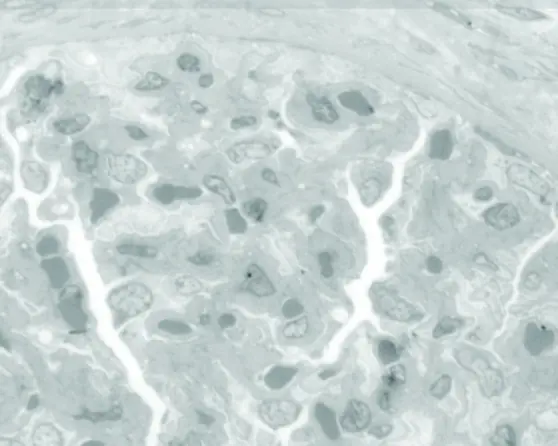 Firm - Comparison of toluidine blue staining
