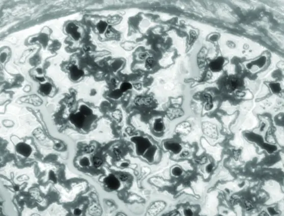 FIRM - on near adjacent sections of human kidney