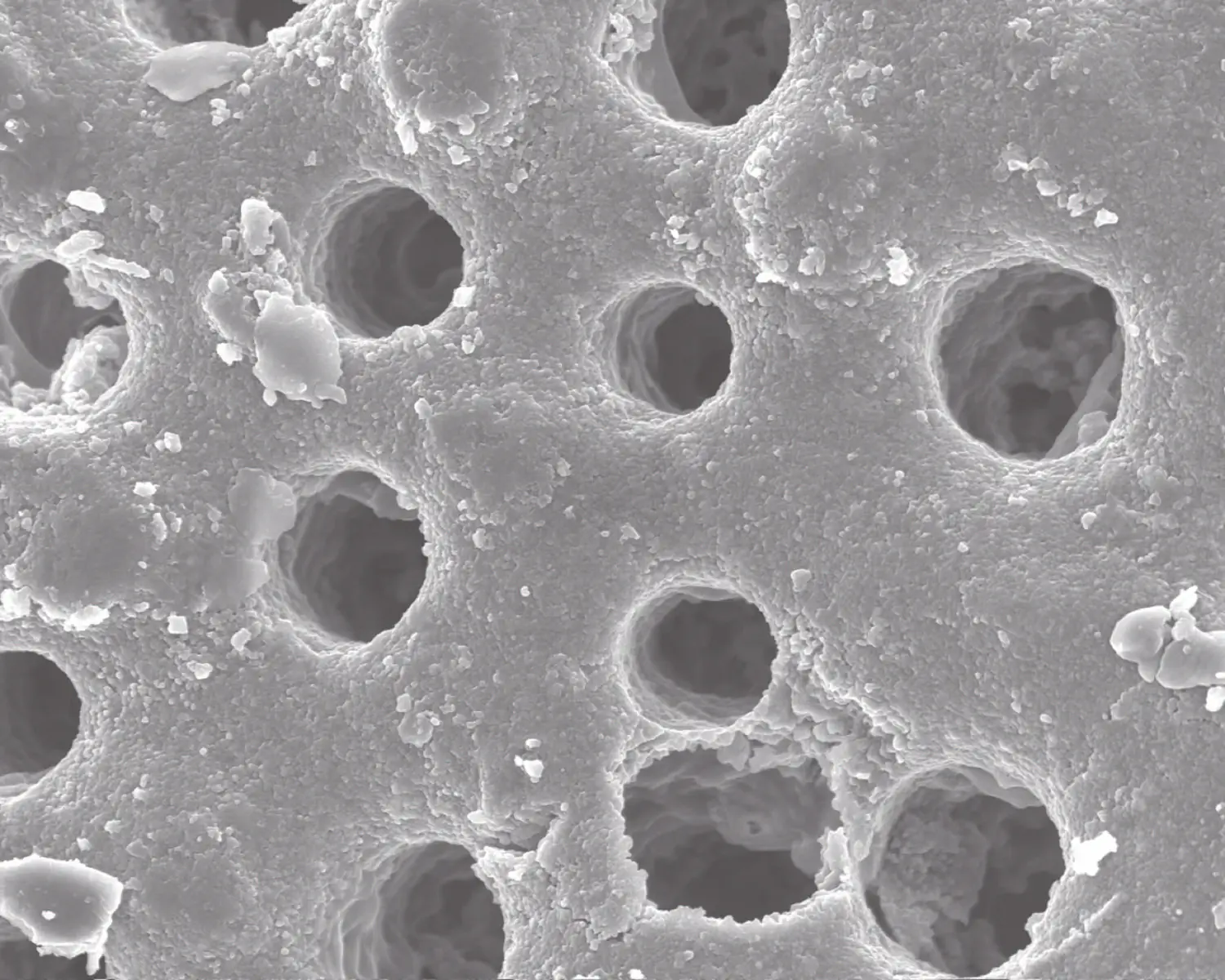 Sternensand die Schale von Foraminiferen (raue und por&ouml;se Oberfl&auml;che, Kalkstein) - Osmium-Beschichtung; 10.000x