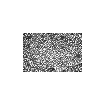 Gold on Carbon Test Standard, very high resolution