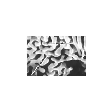 REM Testobjekt, Aluminium-Wolfram Dendriten, 1 Stück