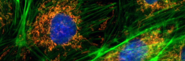 fluorescence_Bovine-Pulmonary-Artery-Cells_Axiocam-203-mono_600x200