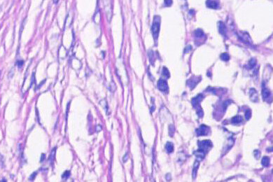 histology-lung_lcm_390x260