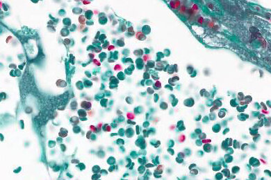 brightfield_blood-vessels_axiolab-5_390x260