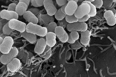 sem_bacteria_evo_390x260