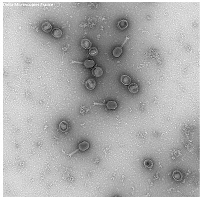 phage1