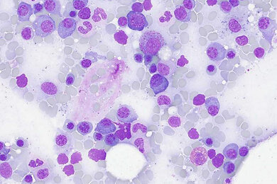 brightfield_bone-marrow_axioscope-5_390x260