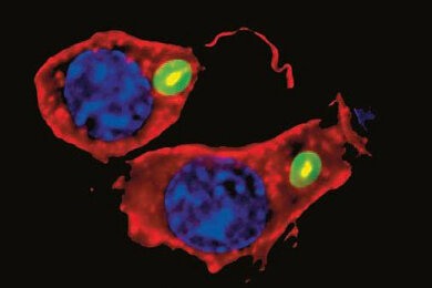 fluorescence_macrophage_axiocam-mrm_390x260