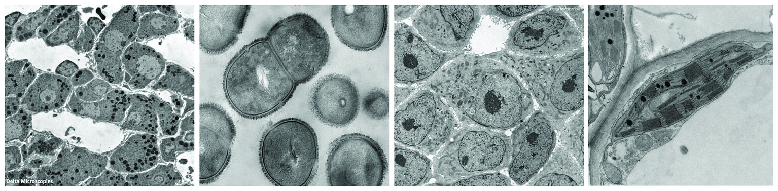 Fokus_auf_Substitutes_for_Uranyl_Acetate_Bild_UranyLess_x4