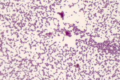 staphylococcus-bacteria_gram-staining_axio-lab-a1_390x260