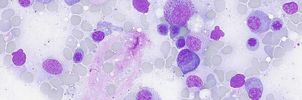 brightfield_bone-marrow_axioscope-5_600x200