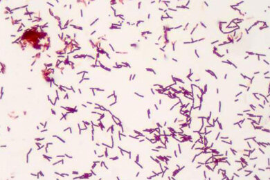 bacillus_gram-staining_axio-lab-a1_390x260