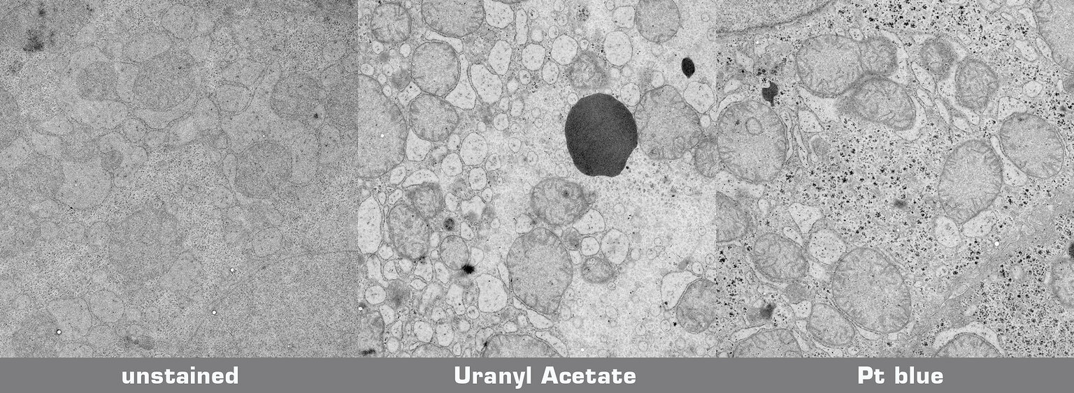 Sammlung_F_rbung_Liver_EN