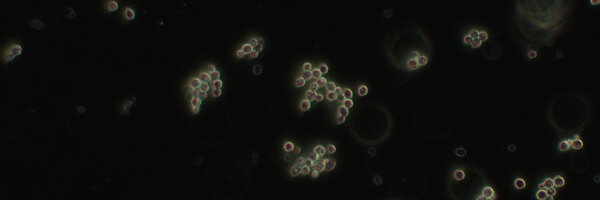 Darkfield_yeast_Axio-Lab-A1_1__600x200